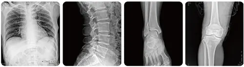 PLX5100-Mobile-Digital-Radiography-System-05