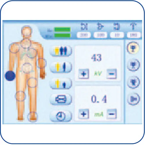 PLX7200High-Frequency-Mobile-digital-C-arm-System-(Cone-Beam-CT)-05