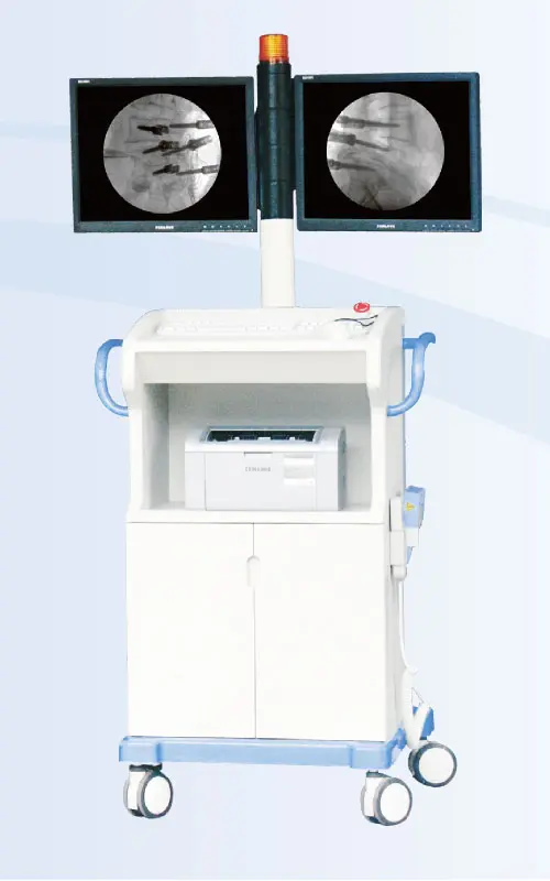PLX7200High-Frequency-Mobile-digital-C-arm-System-(Cone-Beam-CT)-10