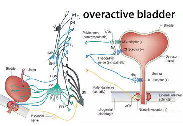 【Clinical Case】-Application of Large Image Output C-arm in Sacral Nerve Modulation Surgery