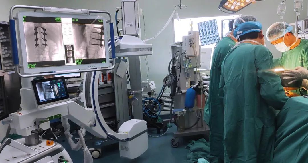  Perlove Medical integrated  large FPD C-arm C-Arm丨Infusing the power of technology into cross-border medical and healthcare services!